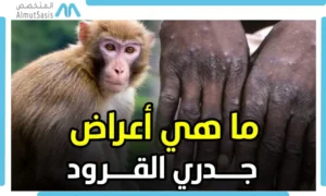 ما هو جدري القرود وأعراضه